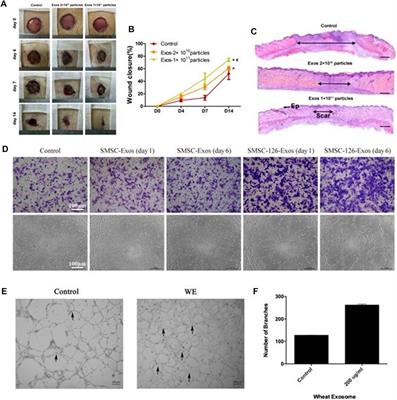 Exosomes based advancements for application in medical aesthetics